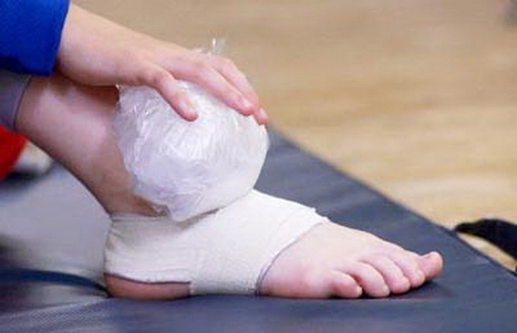 Chườm đá tại vị trí sưng nề  mỗi ngày 3-4 lần để điều trị bong gân.